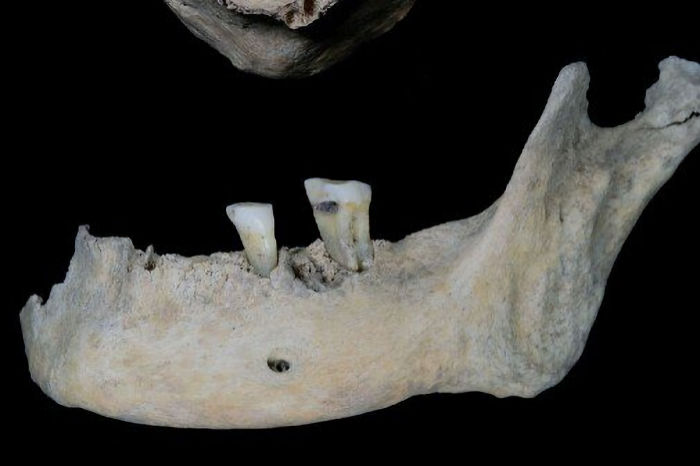 2,000-year-old teeth reveal surprise diet of our Iron Age ancestors 2 teeth reveal surprise diet