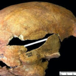 Grizzly Discovery Of An Arrow Through The Eye Sheds Light On Horrific Injuries Caused By Medieval Arrows