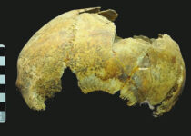 Skull found of 5,000-year-old man who had ancient brain surgery with stone 'scalpel'