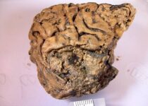How a chunk of human brain survived intact for 2600 years