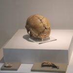 A woman who had brain surgery 9500 years ago will be brought revived