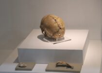 A woman who had brain surgery 9500 years ago will be brought revived