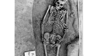 A 7,700-Year-Old Case of Death During Childbirth in Siberia