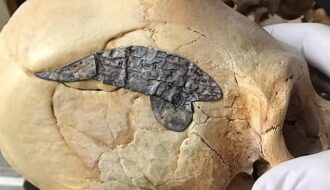 Archaeologists stunned as 2,000-year-old skull bound by metal evidence of ancient surgery