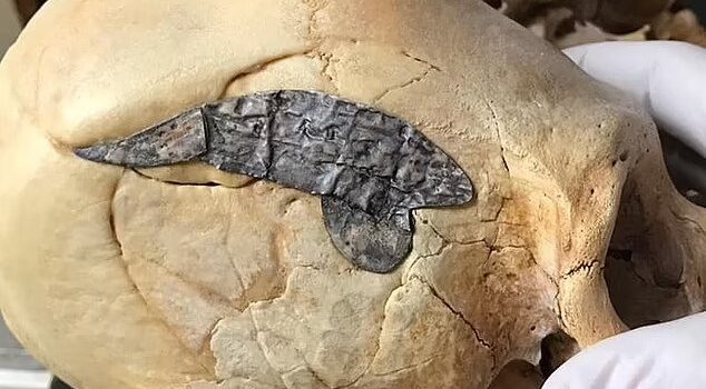 Archaeologists stunned as 2,000-year-old skull bound by metal evidence of ancient surgery