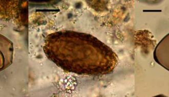 Bronze Age Britons were infected with 'intestinal parasitic worms', study of ancient faeces finds