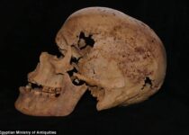 4,200-Year-Old Egyptian Skeleton Shows Signs of Breast Cancer