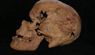 4,200-Year-Old Egyptian Skeleton Shows Signs of Breast Cancer