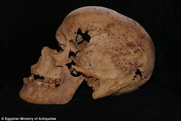 Egyptian Skeleton Shows Signs of Breast Cancer