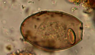 Britons have suffered from WORMS since the Bronze Age